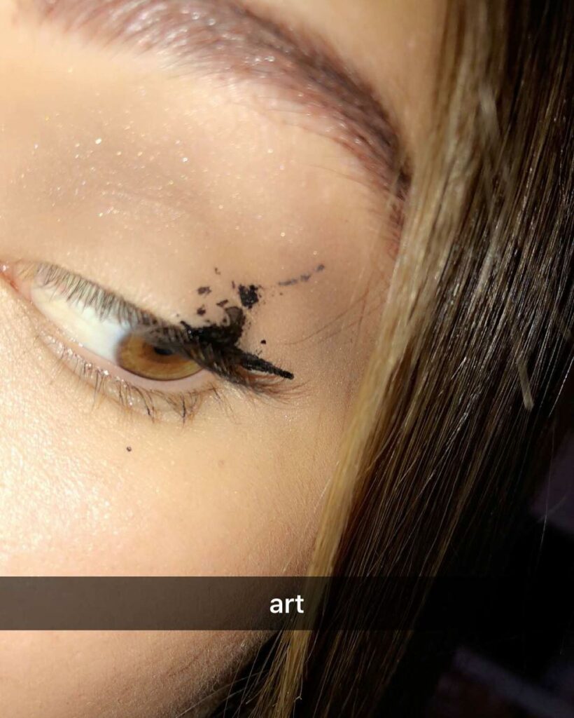 : an accident...