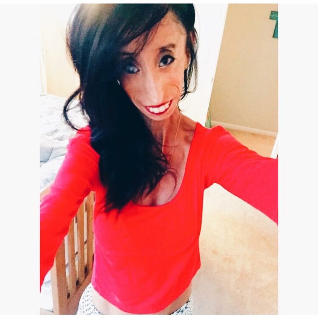 Kylie Jenner: #Day4 – I’m getting a little more personal… When Lizzie Velasquez (@LittleLizz… #Day4 - I'm getting a little more personal... When Lizzie Velasquez (@LittleLizz...
