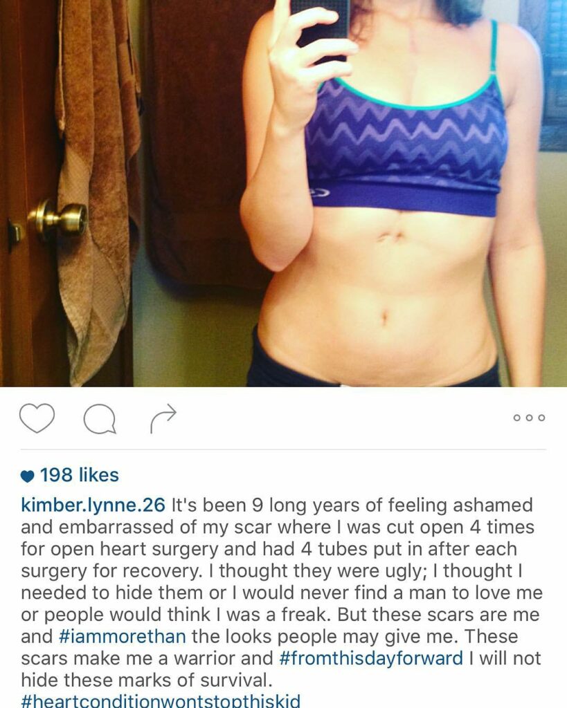thank you so much @kimber.lynne.26 for your #iammorethan post. Very inspiring :)...