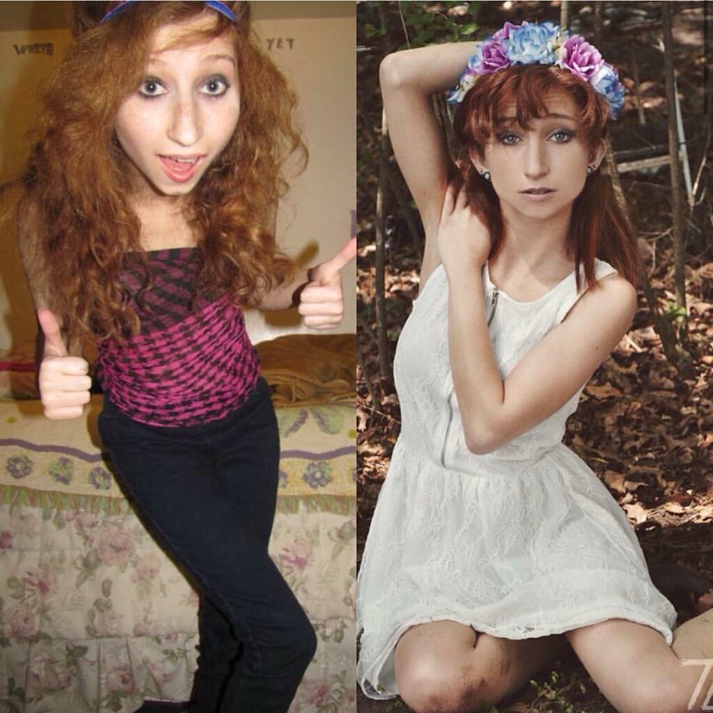 Wow this story! Thank you @christinamcostello_ "The first photo was taken when I...