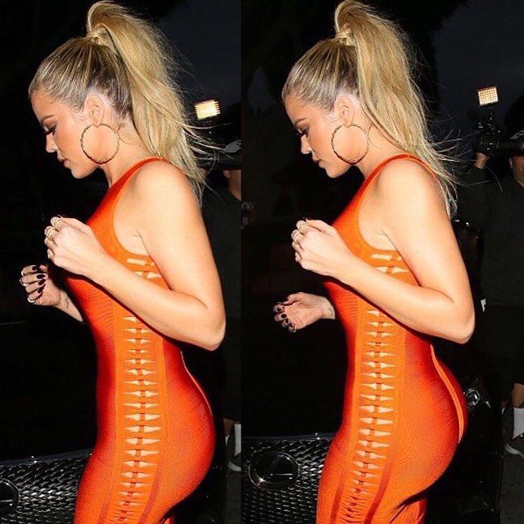 The side detail on this dress is everything ...