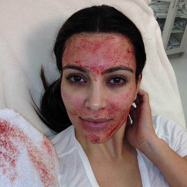 Tonight on Kourtney & Kim Take Miami!!! #VampireFacial #kktm...