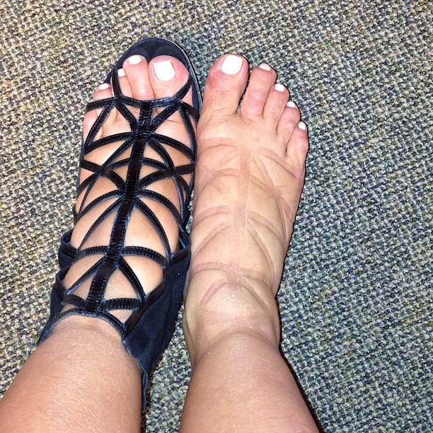 Swollen feet or a new Givenchy tattoo?...