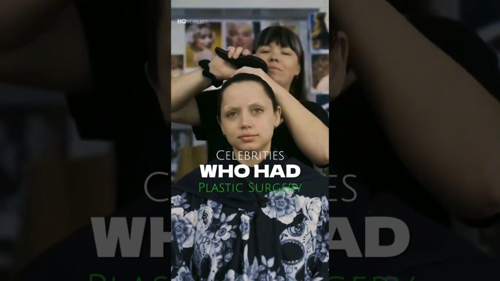 Celebrities Who had Plastic Surgery |