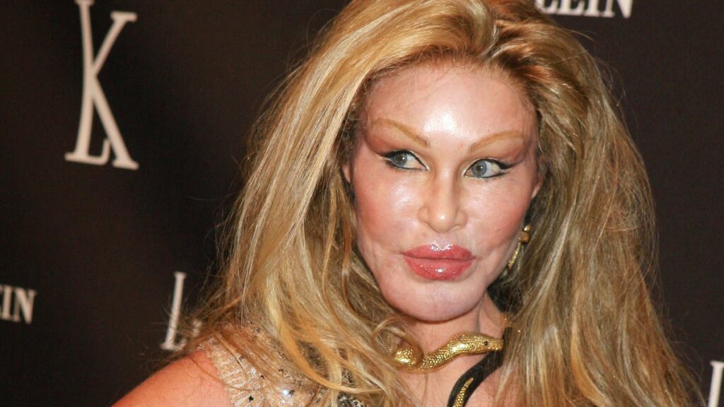 Jocelyn Wildenstein, socialite dubbed ‘Catwoman’ dead at 84: Reports Jocelyn Wildenstein, socialite dubbed 'Catwoman' dead at 84: Reports