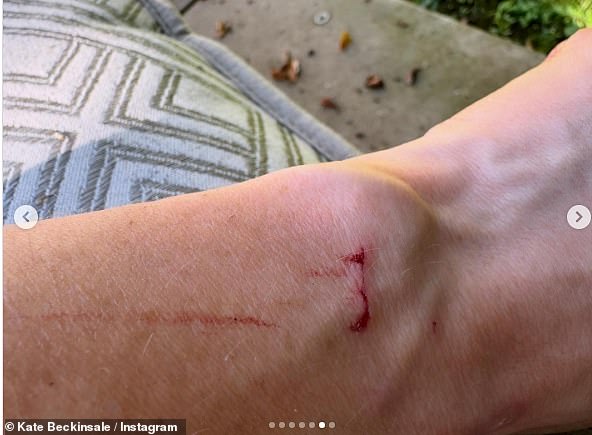 The actress showed her million followers a piece of her bloodied skin that had seemingly been clawed at by the cat