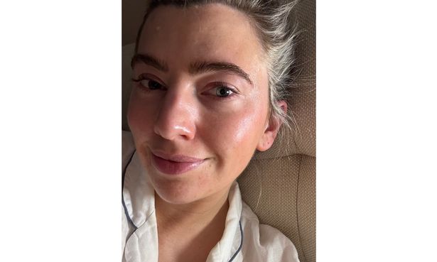 Laura's skin after applying the Medicube cream