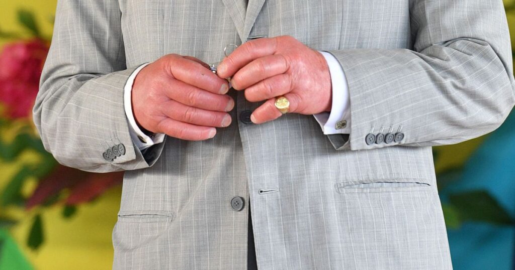 Doctor shares medical explanation for King Charles’ ‘sausage fingers’ Ipso logo