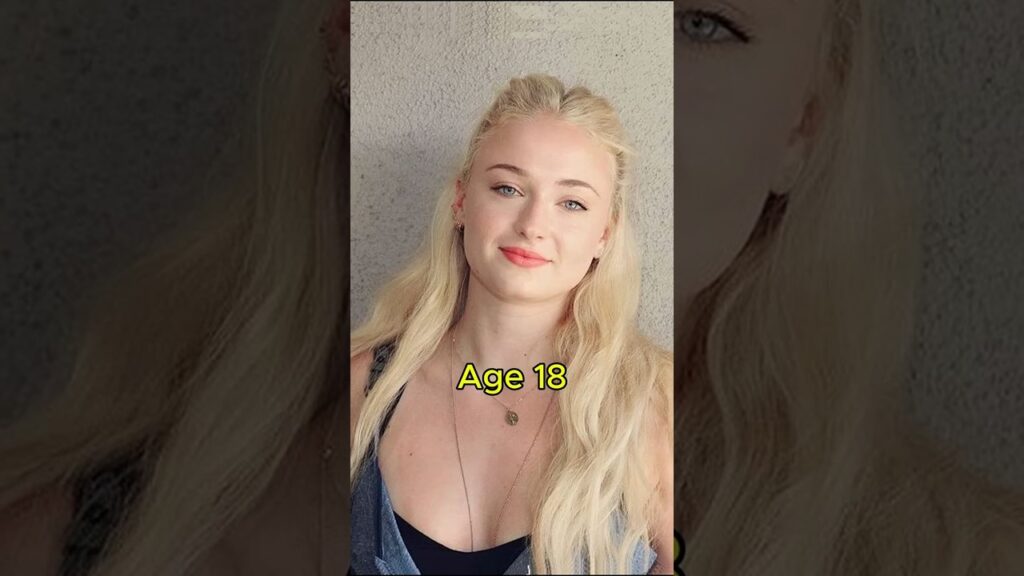 Sophie Turner Before VS After #shorts #sophieturner  #beforeandafter