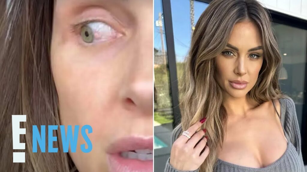 Lala Kent Diagnosed With Pre-Cancerous Eye Growth | E! News Lala Kent Diagnosed With Pre-Cancerous Eye Growth | E! News
