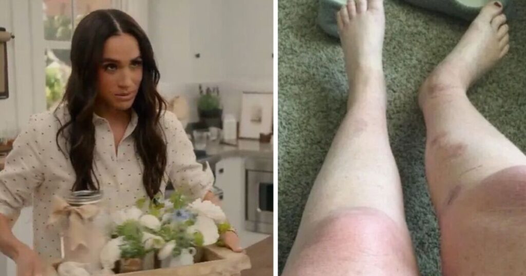 Meghan Markle threatened with £8m lawsuit after Netflix bath salts hack results in ‘burns’ | Celebrity News | Showbiz & TV Meghan Markle threatened with £8m lawsuit after Netflix bath salts hack results in ‘burns' | Celebrity News | Showbiz & TV