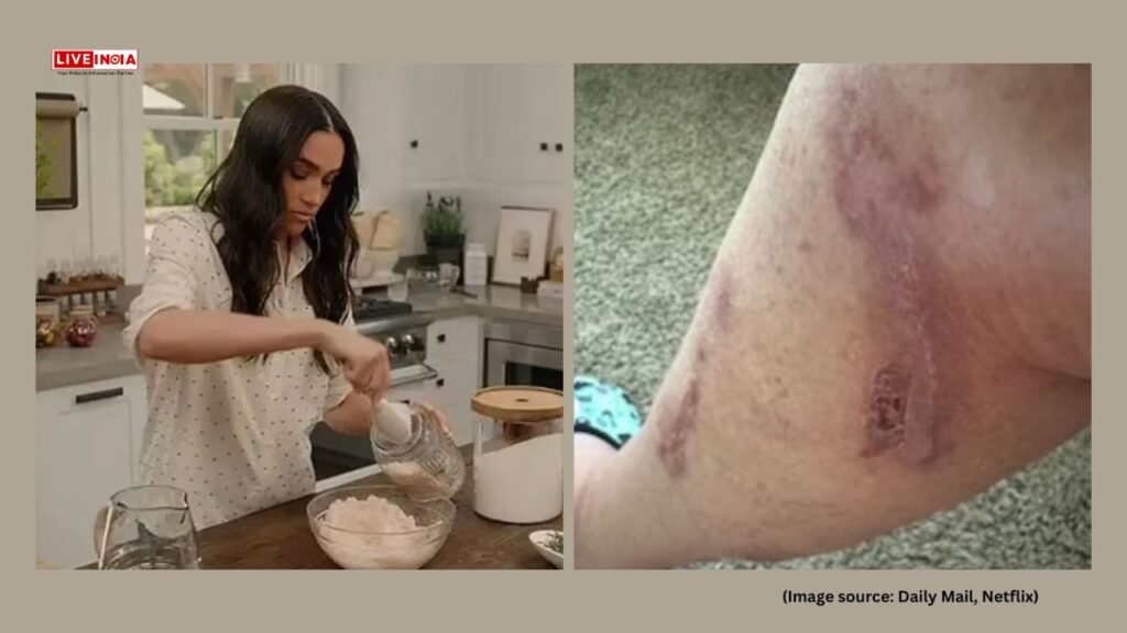 Meghan Markle Faces $10 Million Lawsuit Over Alleged Burns From Bath Salts Featured On Her Netflix Show Meghan Markle Faces $10 Million Lawsuit Over Alleged Burns From Bath Salts Featured On Her Netflix Show