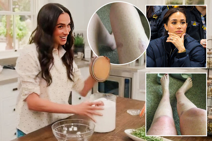 Meghan’s lawyer breaks silence after fan threatened £7m lawsuit because ‘bath salt recipe left catastrophic BURNS’ Meghan’s lawyer breaks silence after fan threatened £7m lawsuit because ‘bath salt recipe left catastrophic BURNS'
