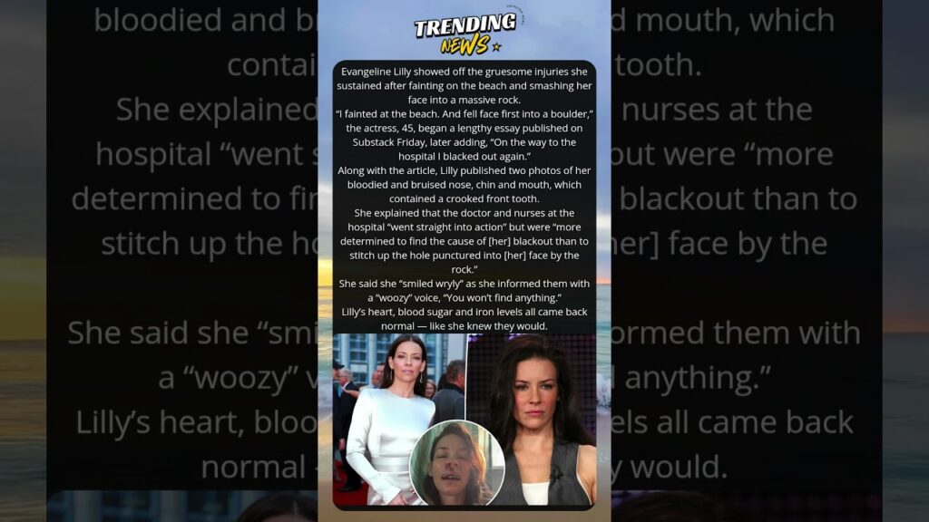 Evangeline Lilly shows off gruesome face injuries after fainting on the beach Evangeline Lilly shows off gruesome face injuries after fainting on the beach