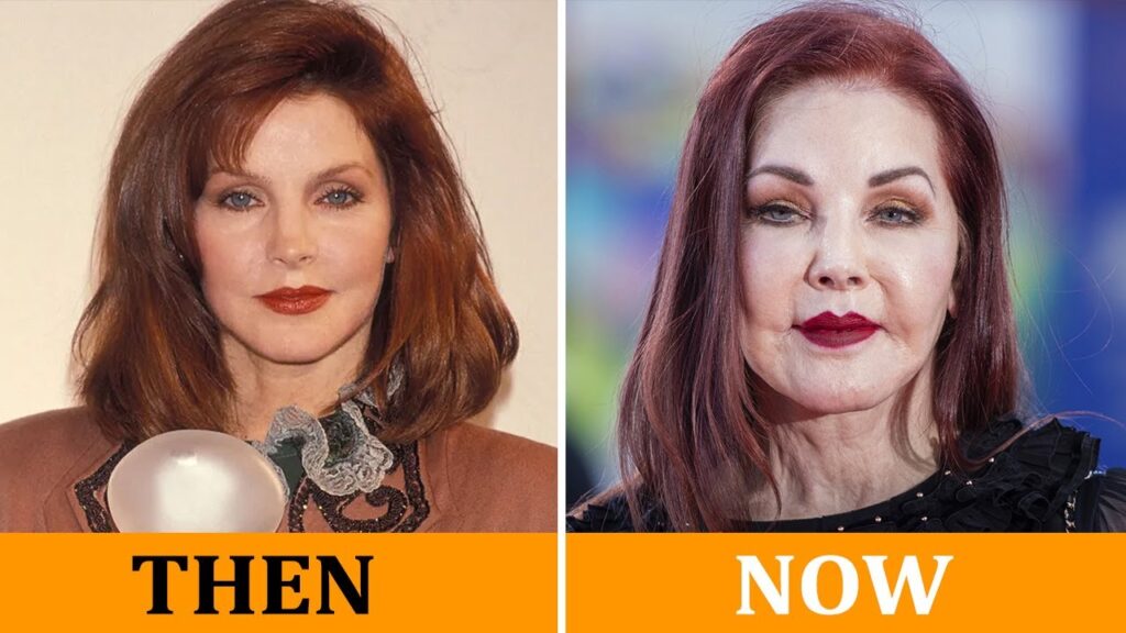 Famous Hollywood Celebrities Before and After Plastic Surgery – Then and Now Famous Hollywood Celebrities Before and After Plastic Surgery – Then and Now