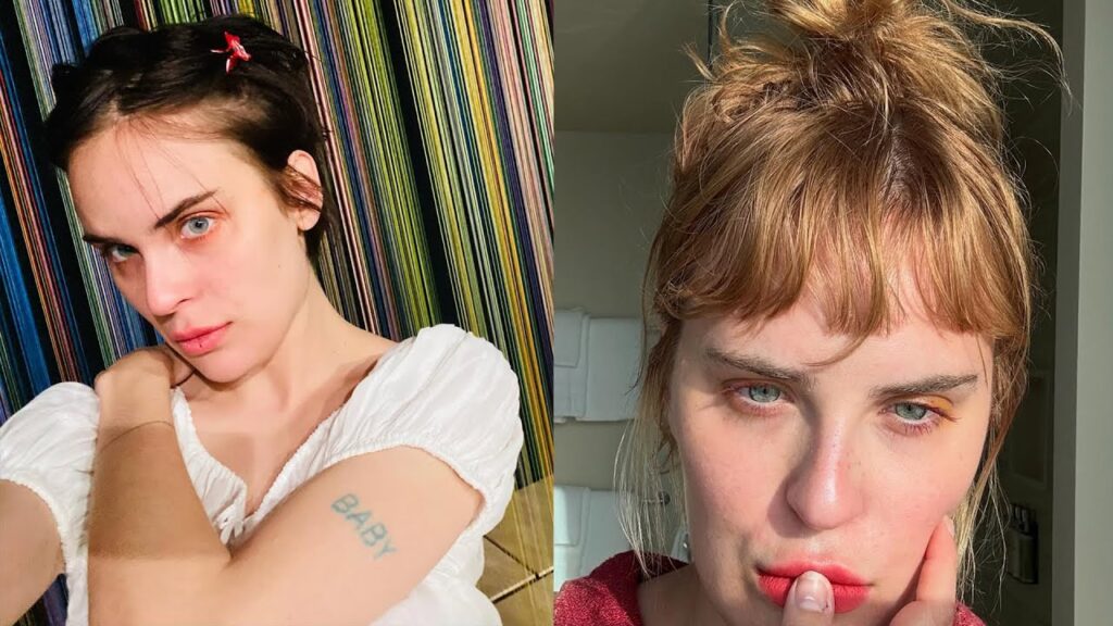 Tallulah Willis Details Hair Loss Amid “Severe” Anorexia Battle Tallulah Willis Details Hair Loss Amid "Severe" Anorexia Battle