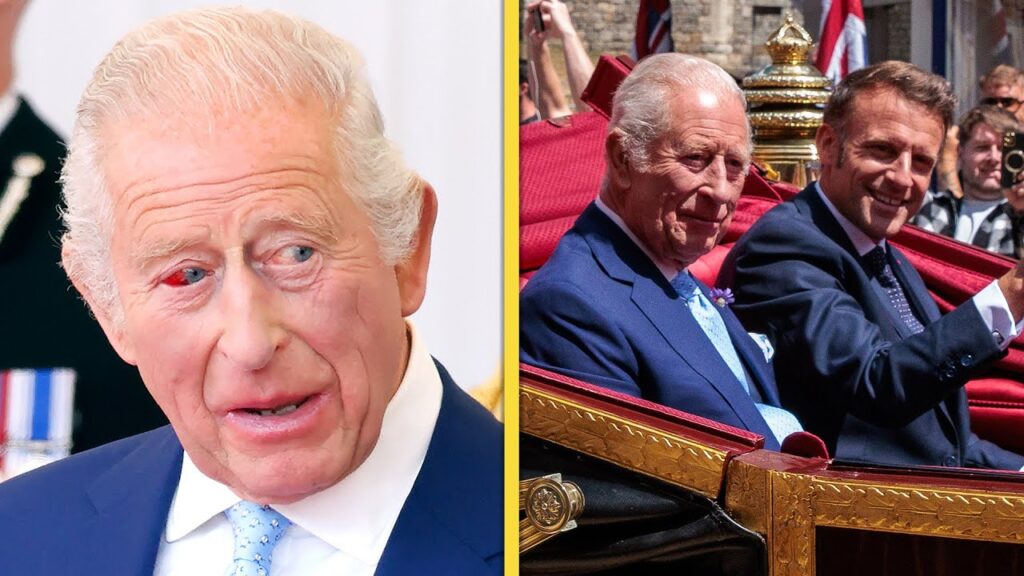 King Charles’ Eye Injury EXPLAINED by the Palace King Charles' Eye Injury EXPLAINED by the Palace