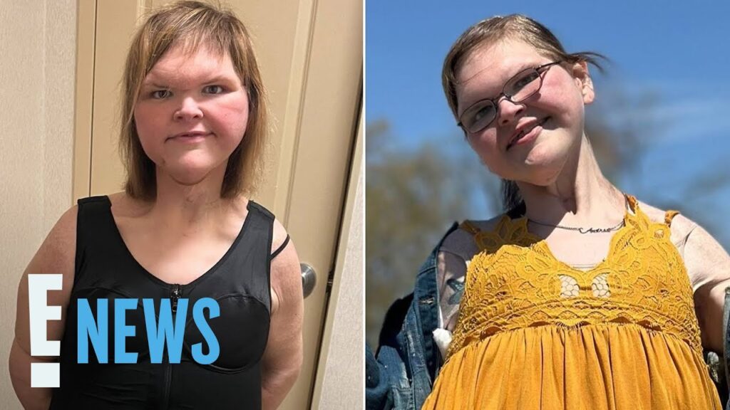 Tammy Slaton Shows Off Figure in Shapewear After Skin Removal Surgery | E! News Tammy Slaton Shows Off Figure in Shapewear After Skin Removal Surgery | E! News