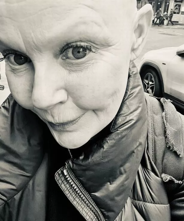 Gail Porter in black and white selfie without wig