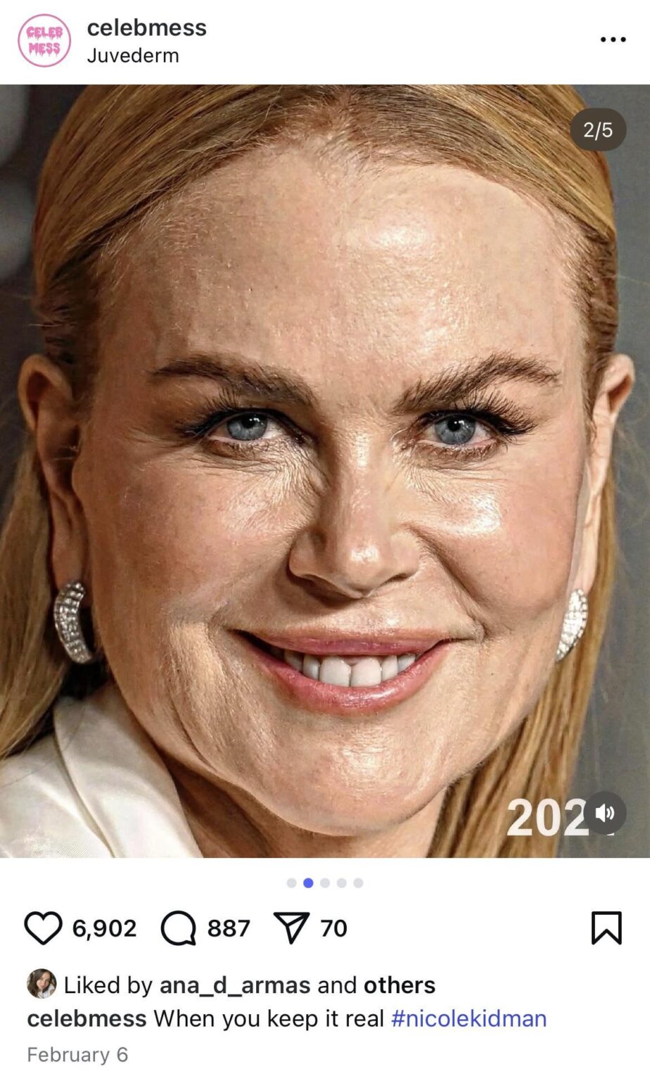 Ana De Armas “Liked” This Mean Photo About Nicole Kidman’s Looks on Instagram