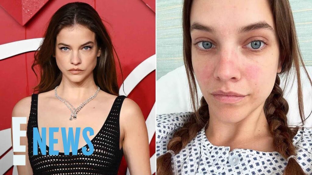 Barbara Palvin Shares Endometriosis Diagnosis | E! News Barbara Palvin Shares Endometriosis Diagnosis | E! News