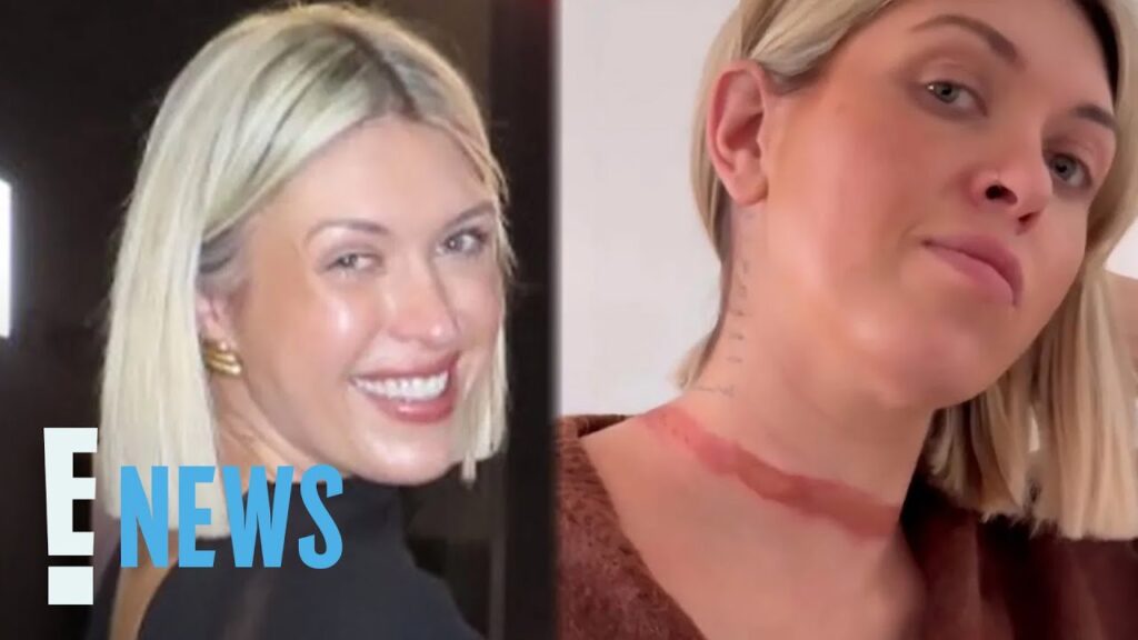 Influencer Nearly Decapitated After Scarf Gets Stuck Under Moving Car | E! News