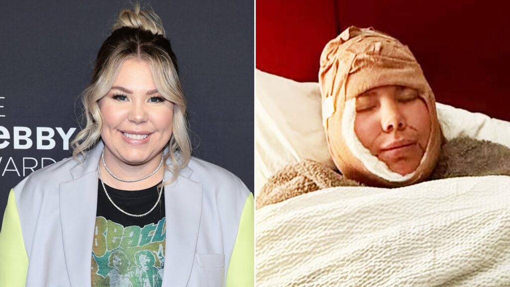 Kailyn Lowry Defends Decision to Surgically Remove Her “Double Chin”