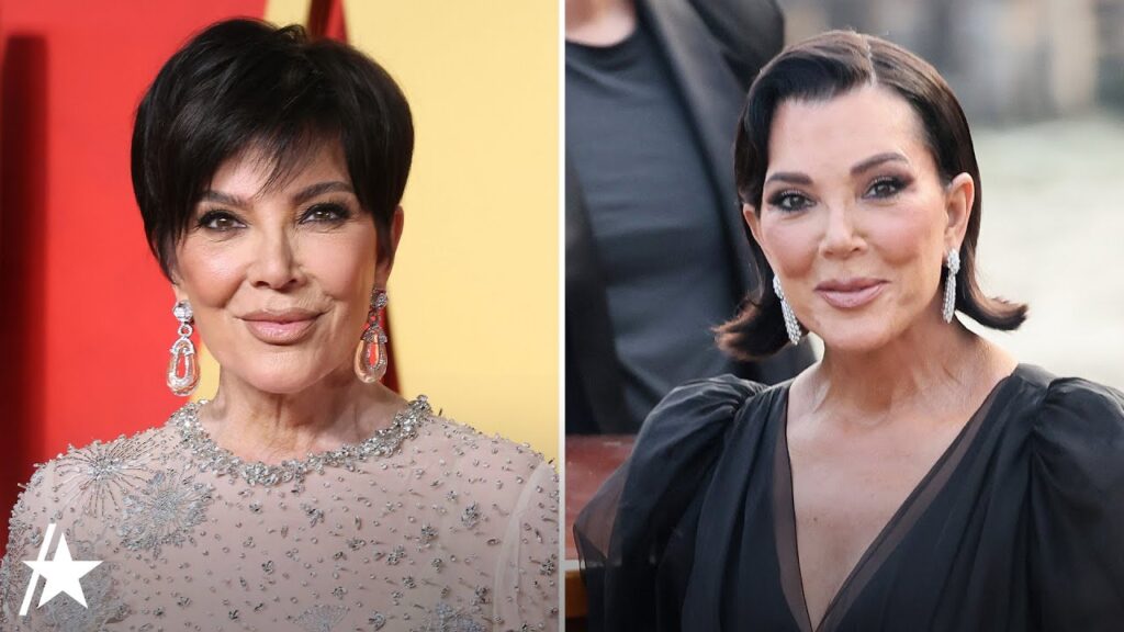 Kris Jenner Speaks Out On Viral FACELIFT At 69