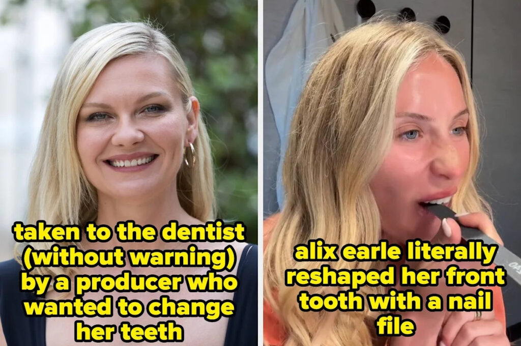7 Celebrities Who Have Been Praised For Their “Unique” Smiles In Hollywood After Refusing To “Fix” Their Teeth Vs. 5 Who Massively Regretted Getting Cosmetic Dental Work Done Yahoo entertainment home
