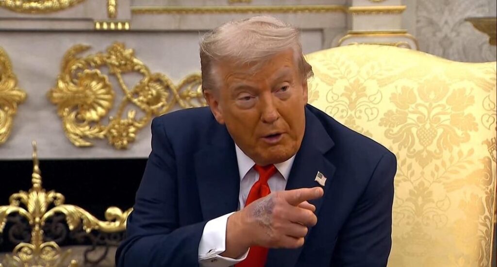 Trump is trying to hide the back of his right hand from cameras but here you can see the nasty bruising on it