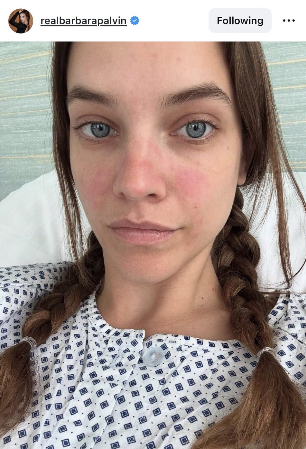 Barbara Palvin-Sprouse shares that she was recently diagnosed with Endometriosis after years of dealing with severe period pain and other symptoms: "If you suspect that you could have endometriosis I encourage you to find it out. It helped me a lot, and I'm grateful I did it." (via IG)