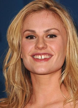 i miss the 90s/early 2000s when celebs had real human teeth. the chips! the gaps! the charm!