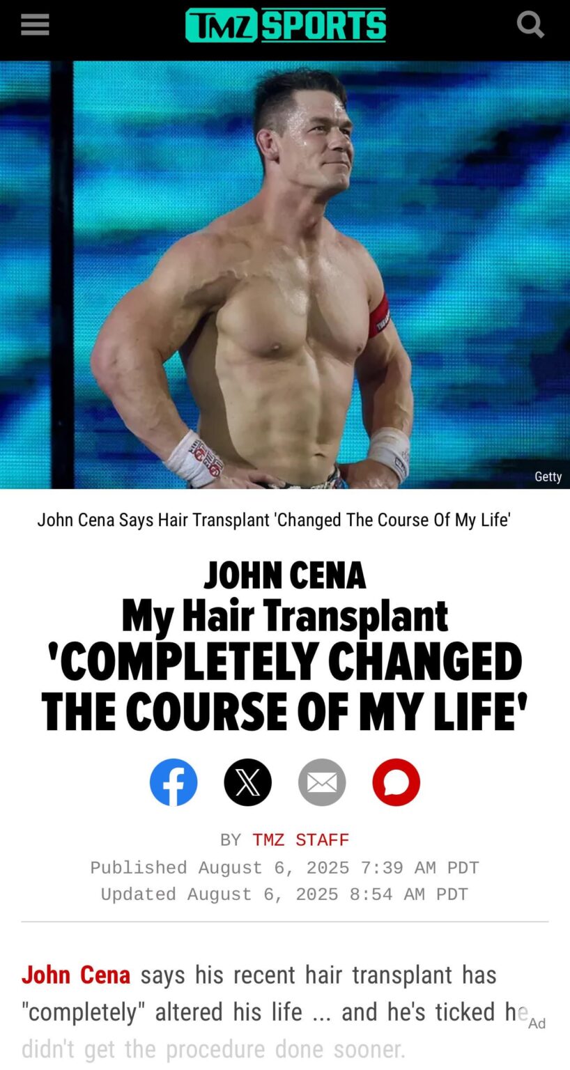 John Cena Says Hair Transplant ‘Changed The Course Of My Life’ John Cena Says Hair Transplant 'Changed The Course Of My Life'