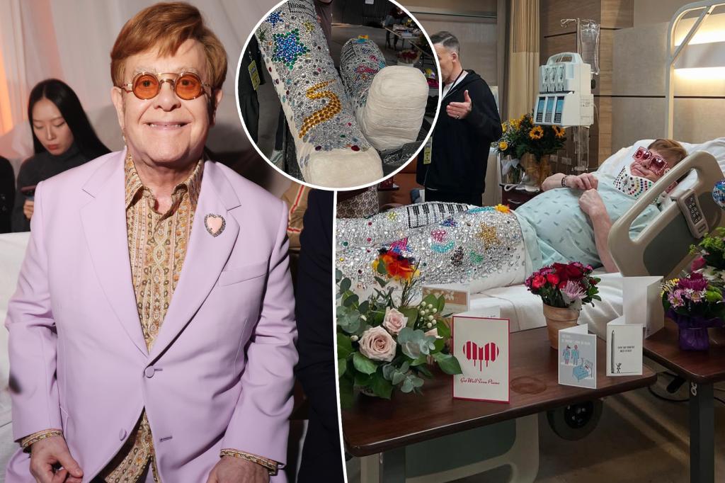 Elton John confuses fans with hospital bed and body cast photos Elton John confuses fans with hospital bed and body cast photos