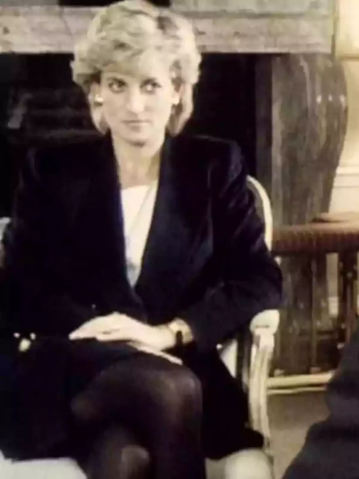 Woman sitting with a serious expression, wearing a dark blazer and black stockings in an elegant room