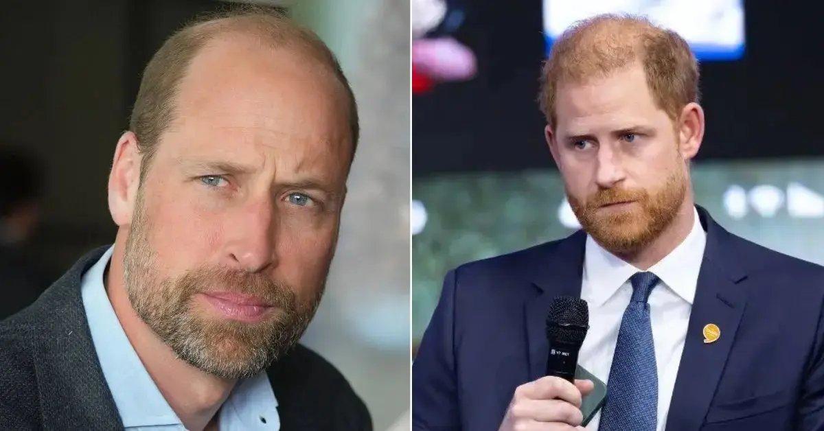 Photo of Prince Harry described William's hair loss as 'alarming.'