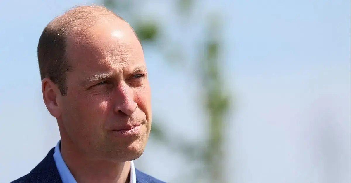 Photo of the Prince of Wales has been losing his hair for years.