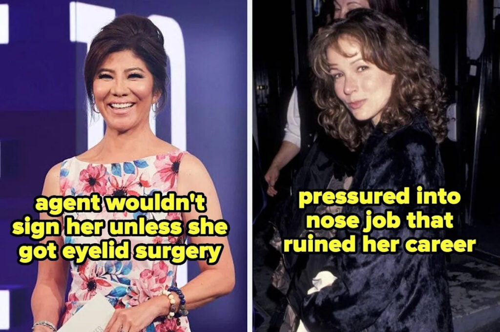 14 Celebs Who Surgically Changed Their Faces And Bodies For Fame Yahoo entertainment home