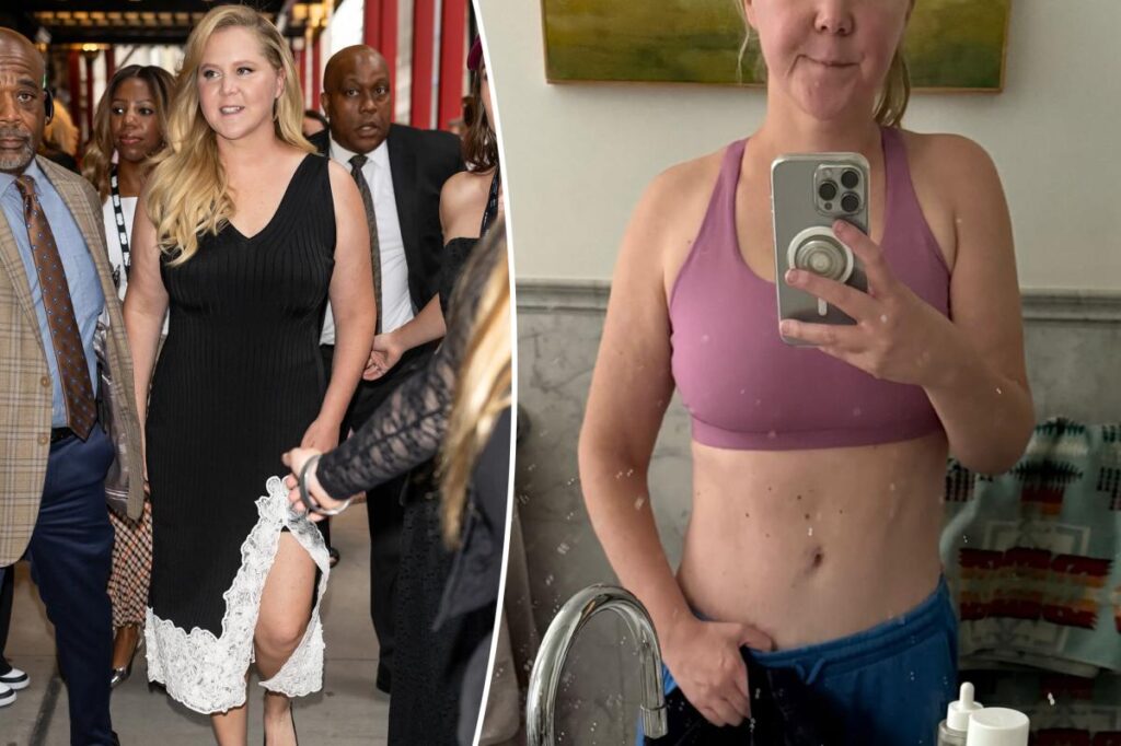 Amy Schumer models flat abs after dramatic weight-loss transformation