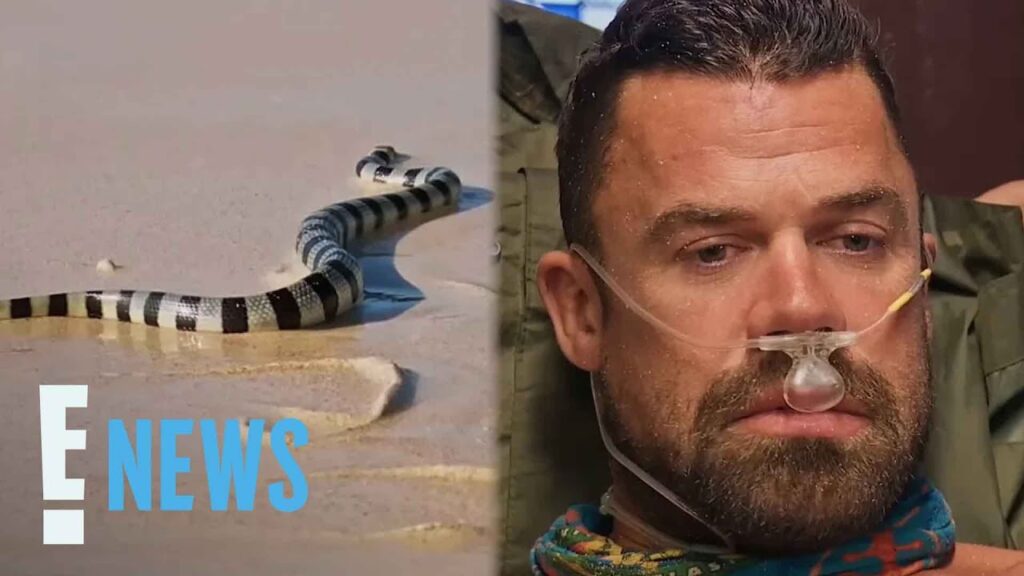 Survivor 49’s Jake Latimer Details Recovery After Being Bit by Snake | E! News