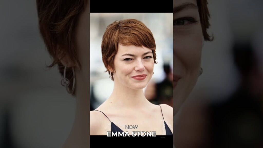 Celebrity Transformations: Young vs Now! 🤯