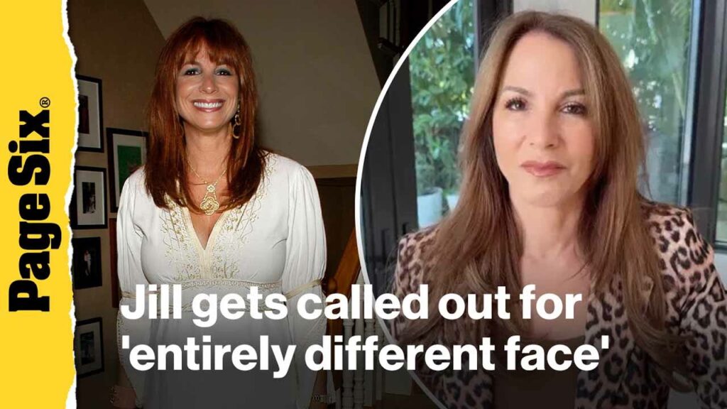 Does ‘RHONY’ alum Jill Zarin have an ‘entirely different face’? Does 'RHONY' alum Jill Zarin have an 'entirely different face'?