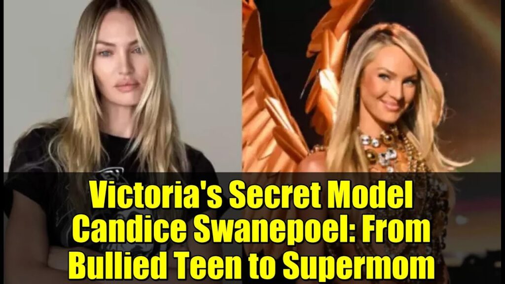 Victoria's Secret Model Candice Swanepoel: From Bullied Teen to Supermom
