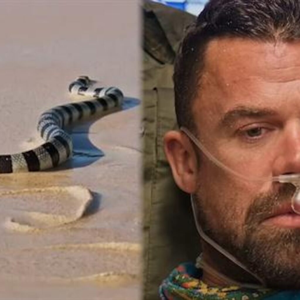 ‘Survivor’ 49’s Jake Latimer Details Recovery After Being Bit by Venomous Snake - E! Online