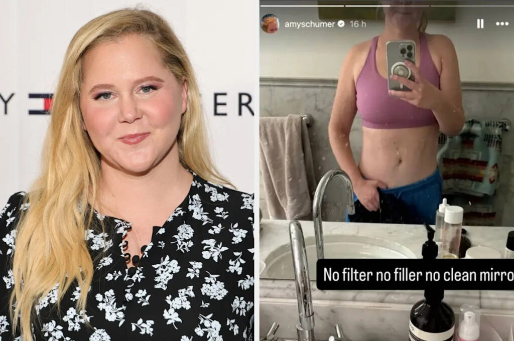 After Her Unfiltered Body Selfie Went Viral, Amy Schumer Said She’s “Enjoying” How She Looks And Shared More Photos Of Herself Post-Mounjaro Yahoo entertainment home