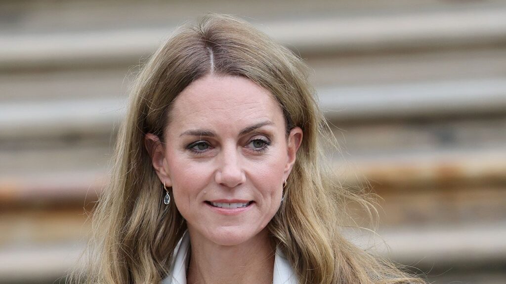 Kate Middleton, Wigs & Why It's No One's Place To Ask
