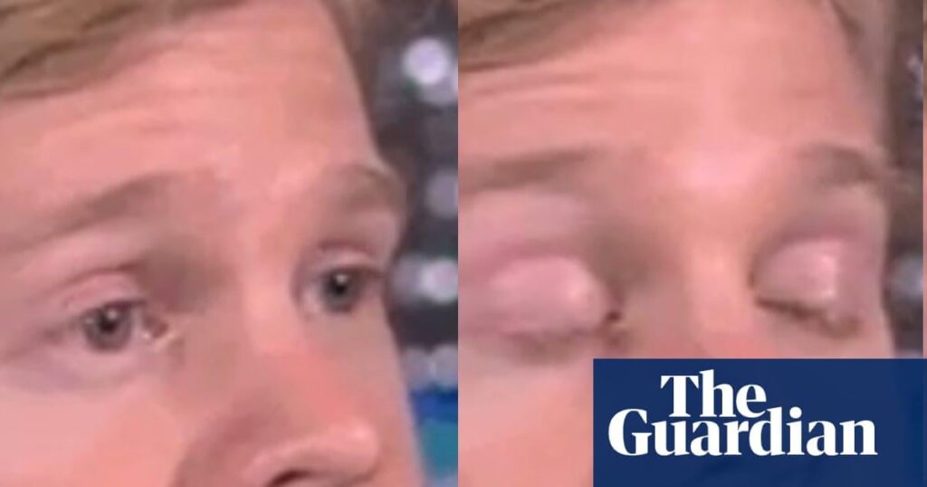 Drew Scanlon - man who became popular in Blinking White Guy gif - raises over $300,000 for multiple sclerosis research.