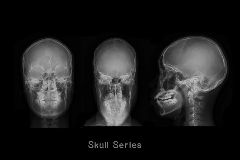 Three X-ray images of a human skull viewed from the front, back, and side, labeled "Skull Series" below