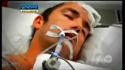 Individual in a hospital bed with a breathing tube, eyes closed, appearing to be receiving medical care