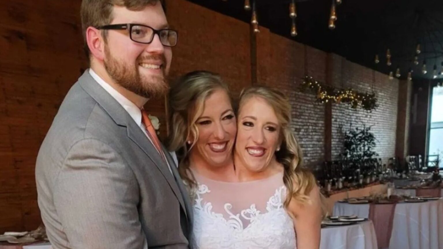 Weird Things About Abby Hensel And Josh Bowling’s Marriage We Can’t Ignore Weird Things About Abby Hensel And Josh Bowling's Marriage We Can't Ignore